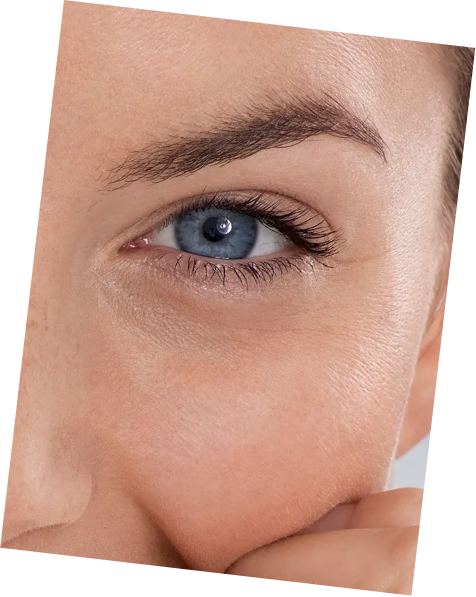 The Importance of Under Eye Care