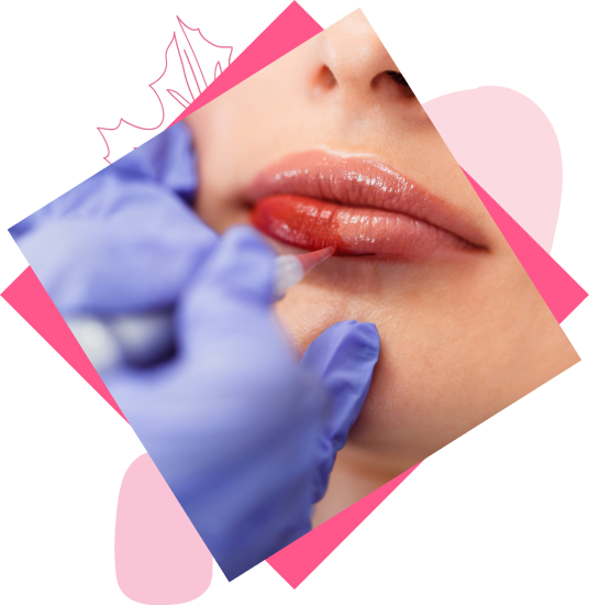 Make Your Lips More Pinkish With Glow by Angela Permanent Lip Tinting!