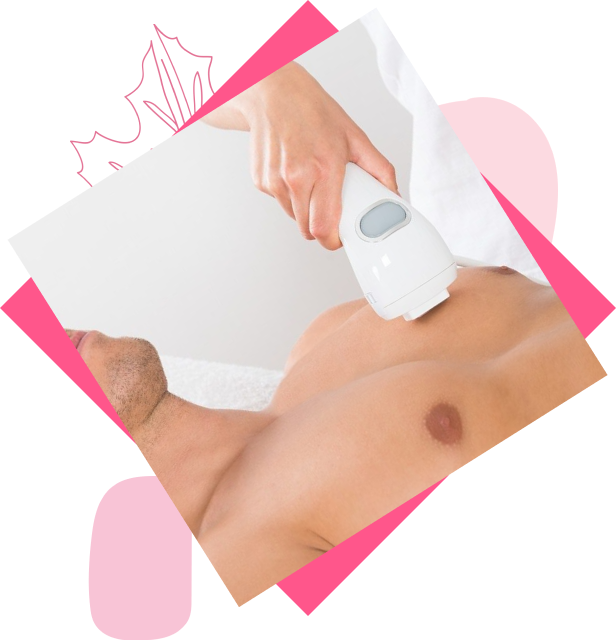 Laser Hair Removal for Female Areolas