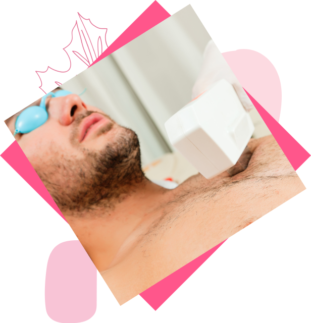 laser hair removal chest