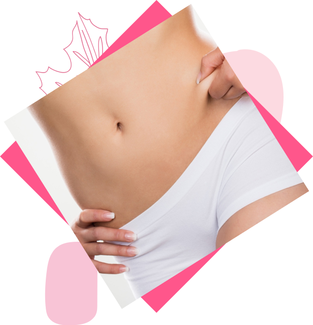 stomach laser hair removal
